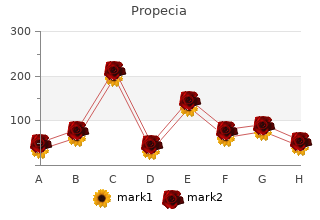 propecia 1mg mastercard