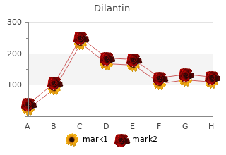 buy dilantin 100mg without prescription