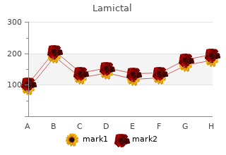 cheap 25 mg lamictal amex