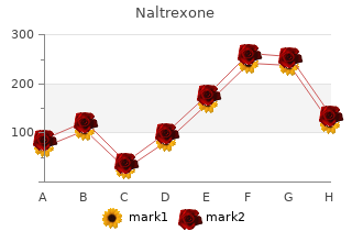 cheap naltrexone 50 mg line