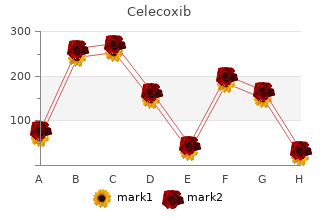 generic celecoxib 200mg amex