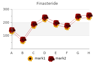 order 5mg finasteride with amex