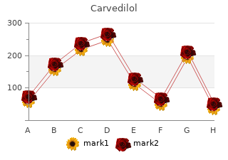 buy discount carvedilol 12.5mg on-line