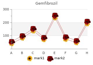 buy gemfibrozil 300mg otc