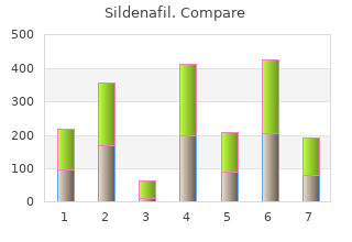 buy 25mg sildenafil free shipping