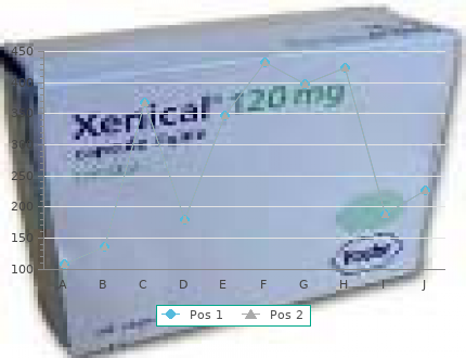 generic 25 mg viagra