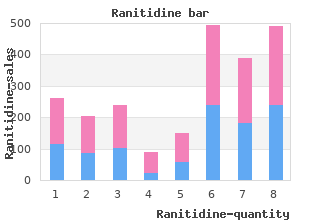 purchase ranitidine 150mg with visa